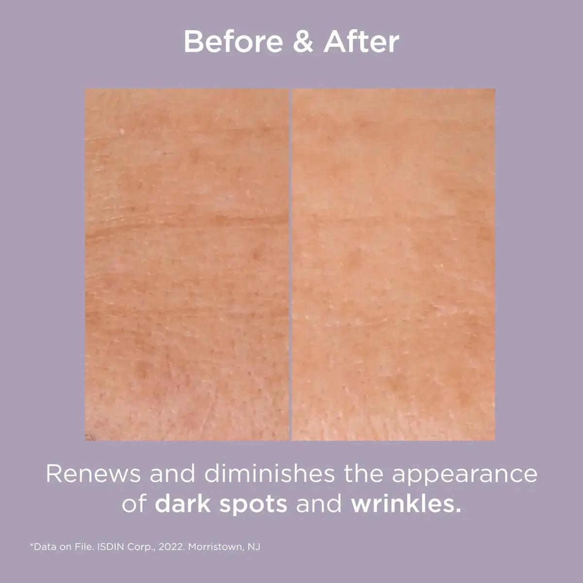 GLICOISDIN GEL- INTENSE 25%