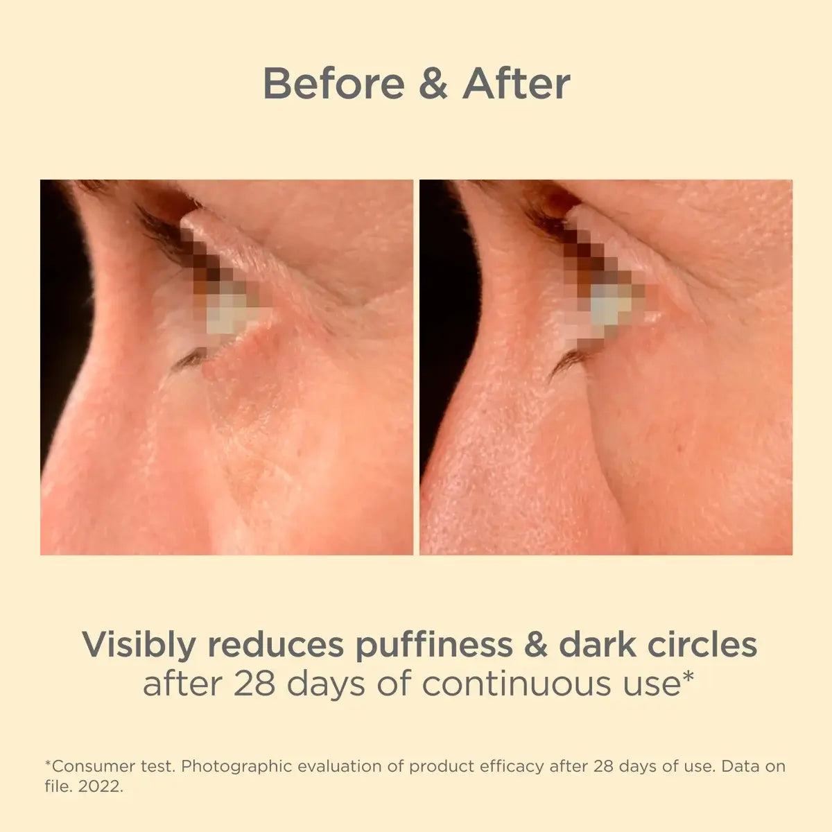 K-Ox Eyes/ Vitamin K oxide eye contour cream