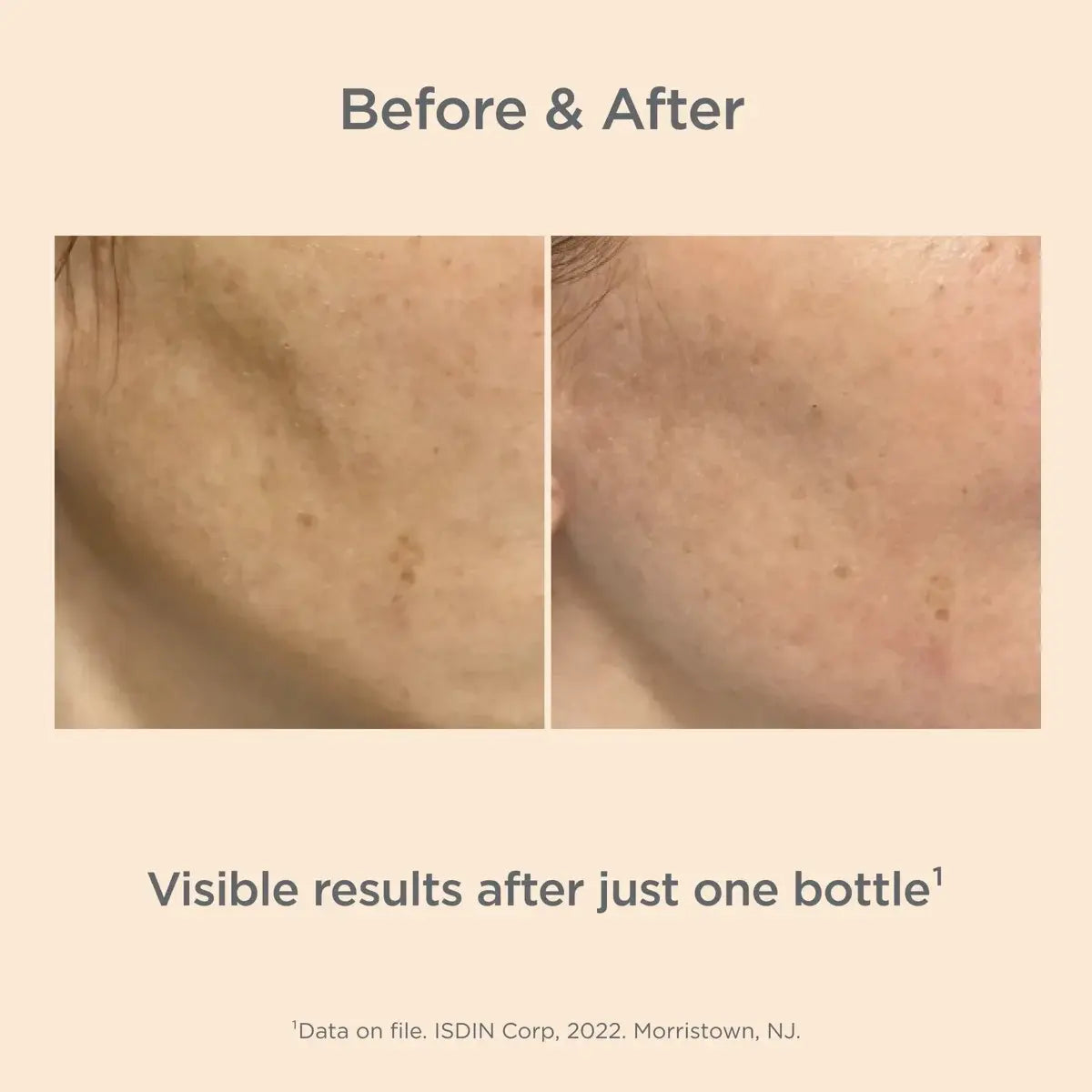 ISDINCEUTICS Melaclear Advanced